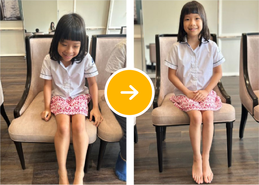 Before After 1