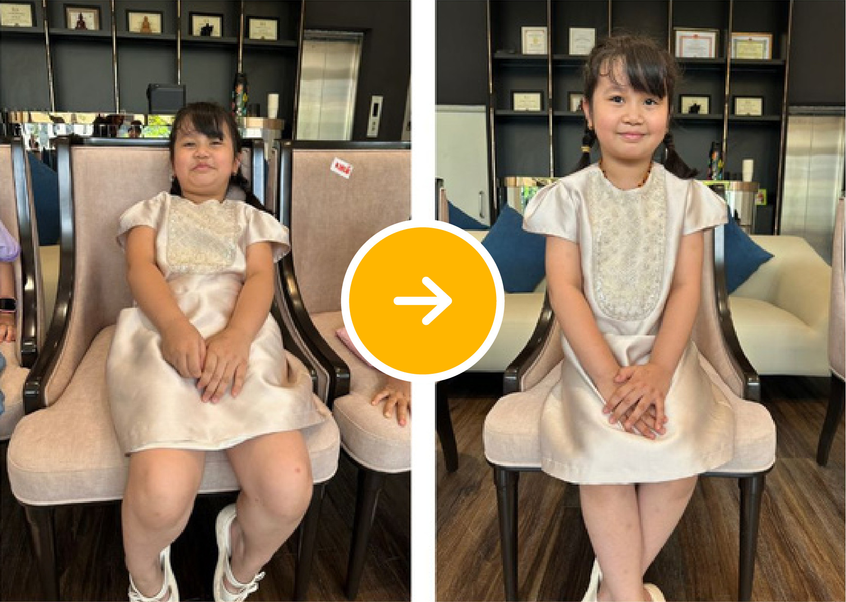 Before After 10