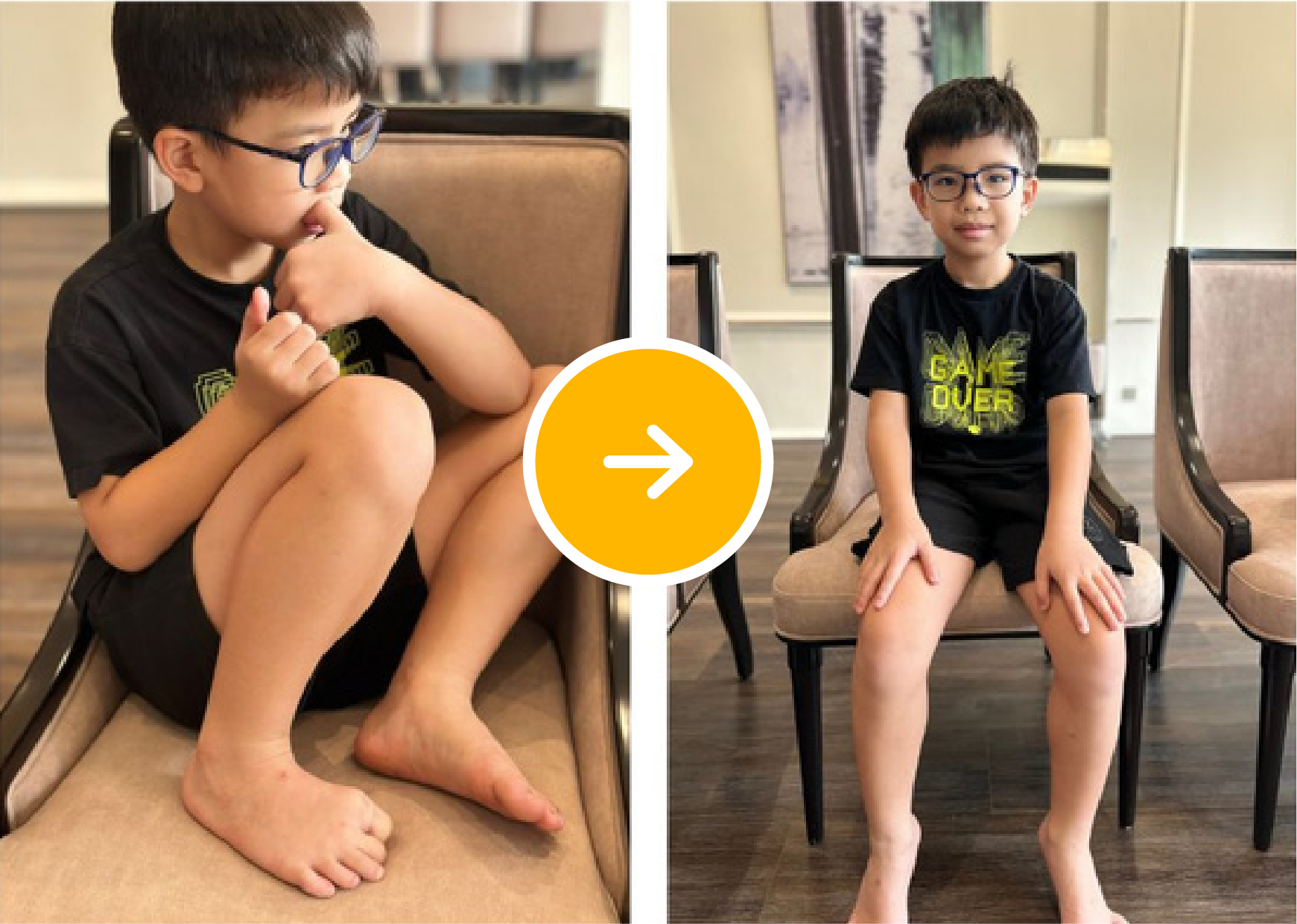 Before After 11