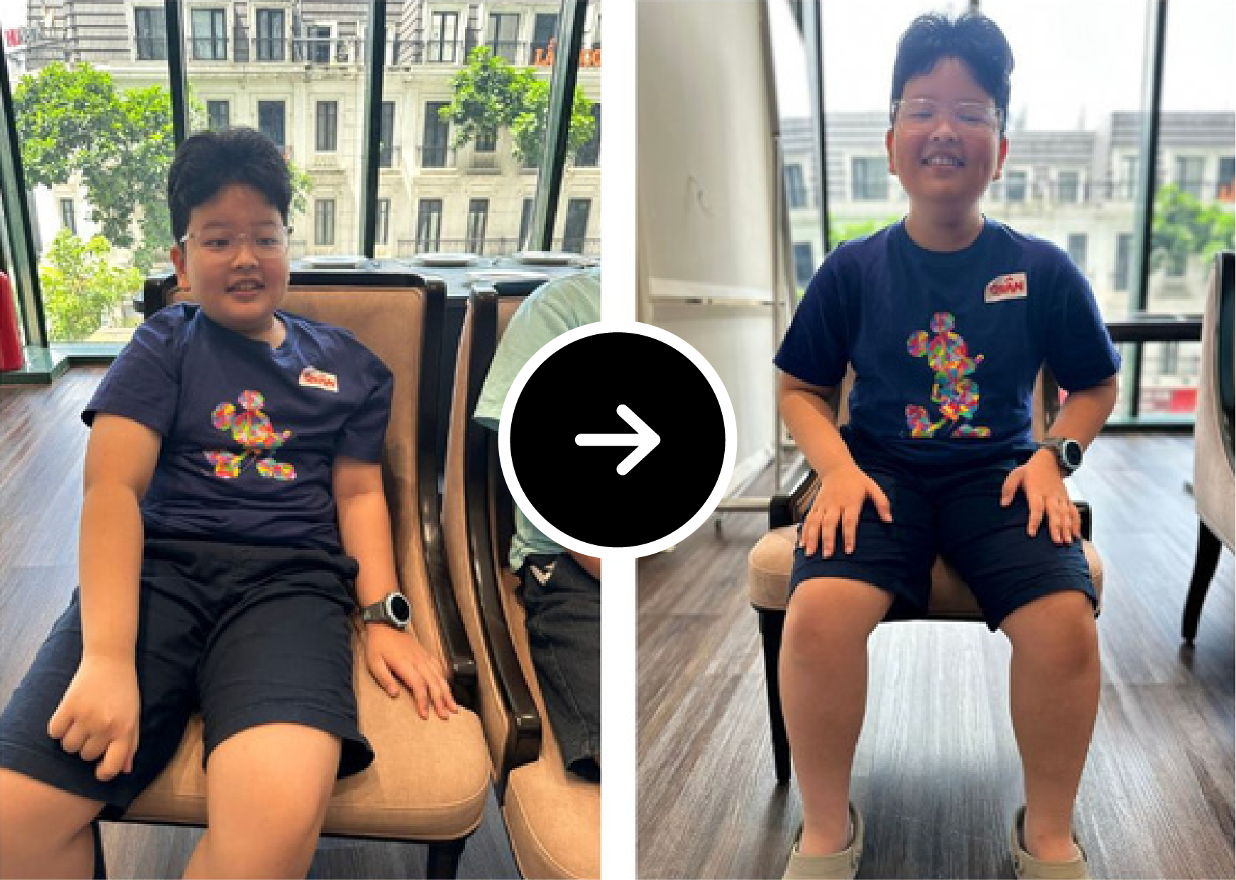 Before After 12