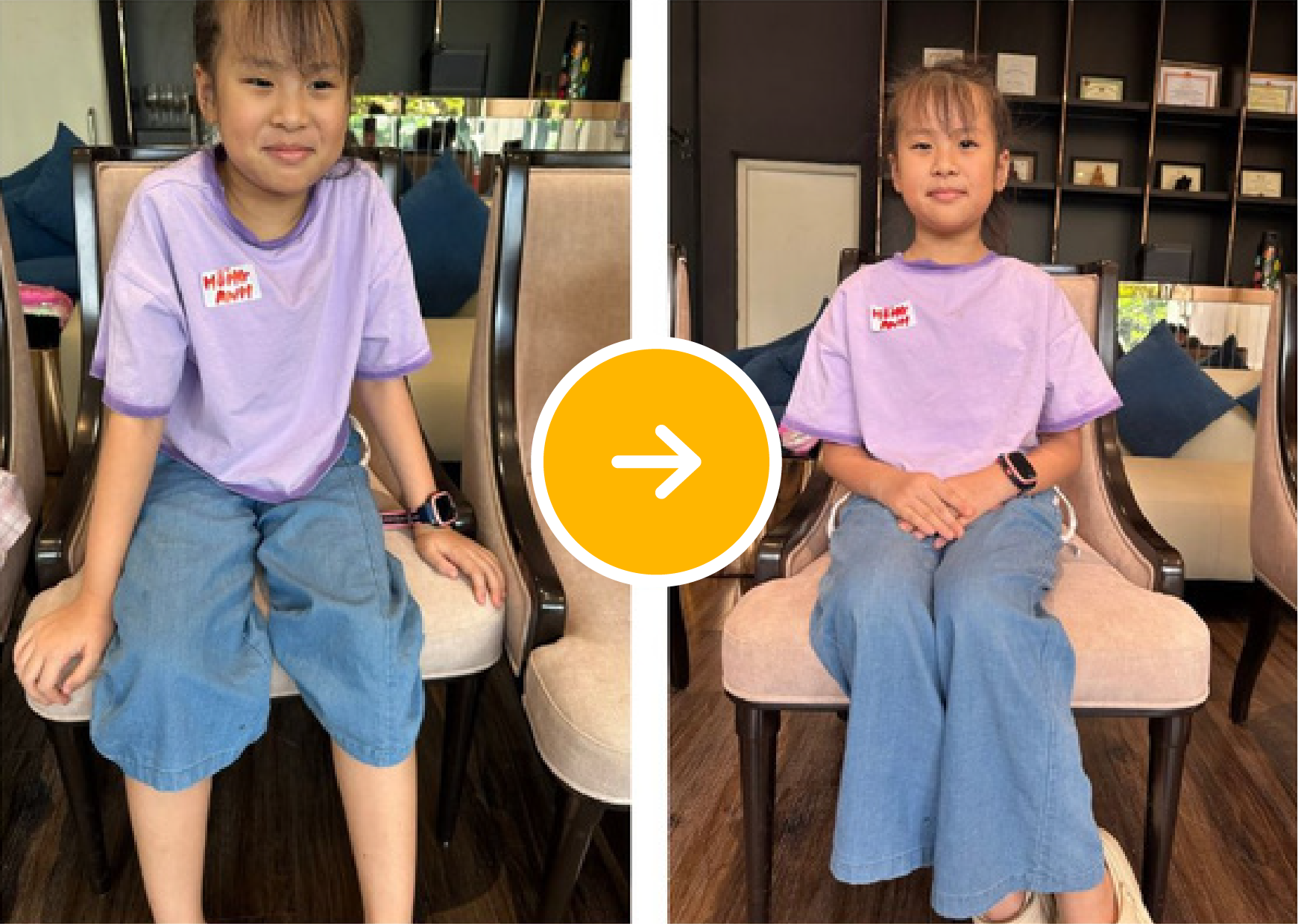 Before After 13