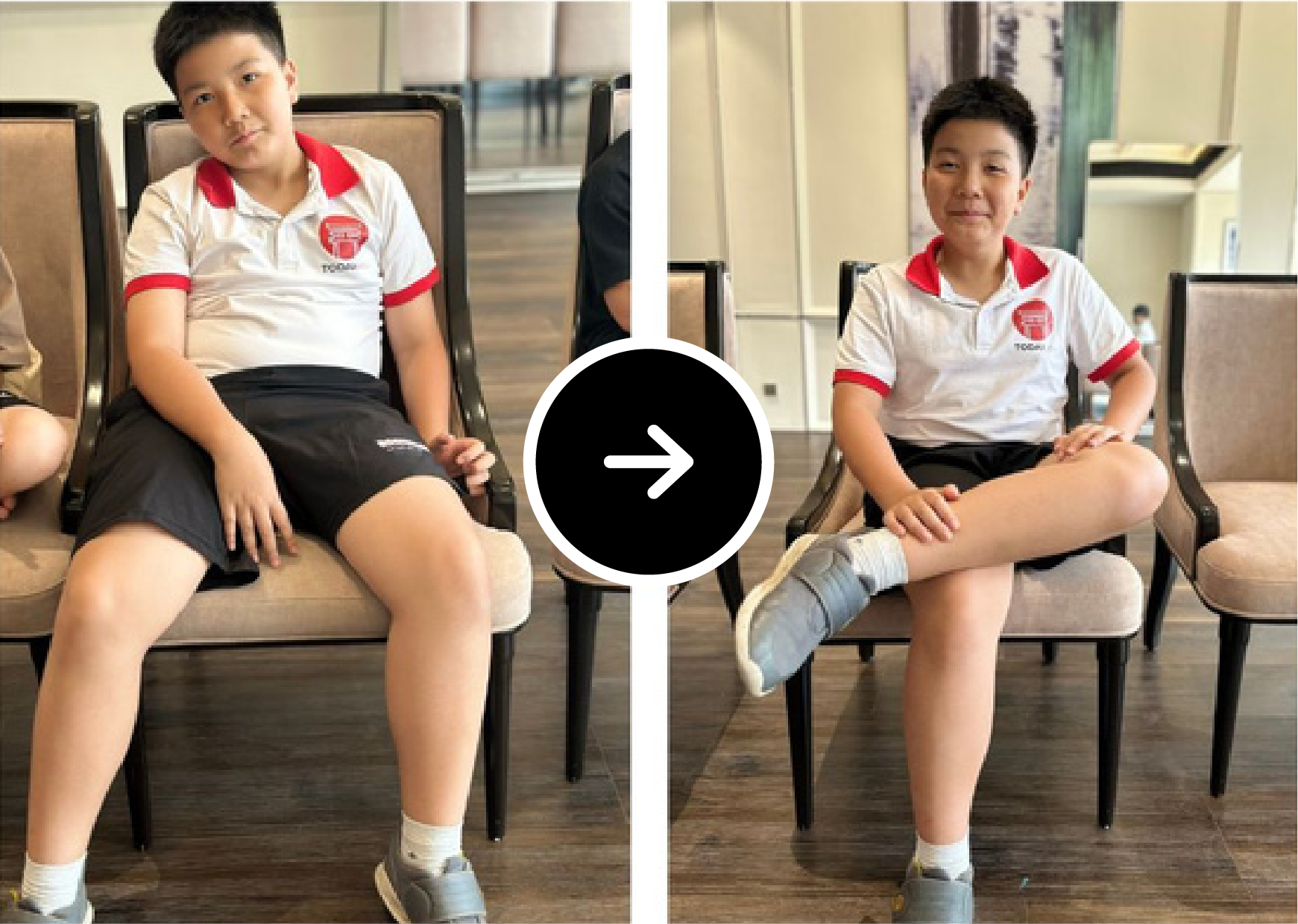 Before After 14
