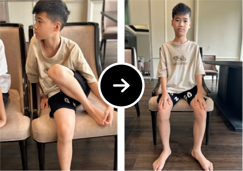 Before After 2