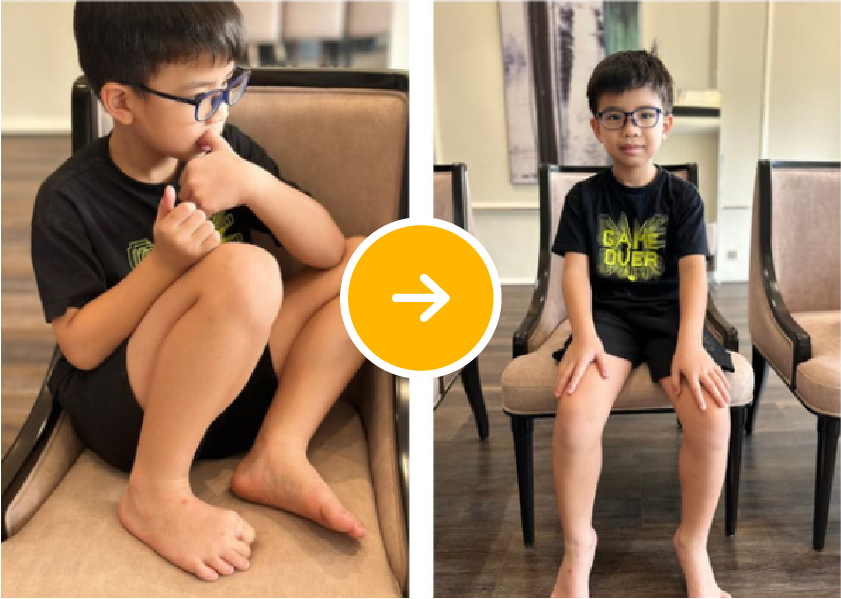 Before After 3